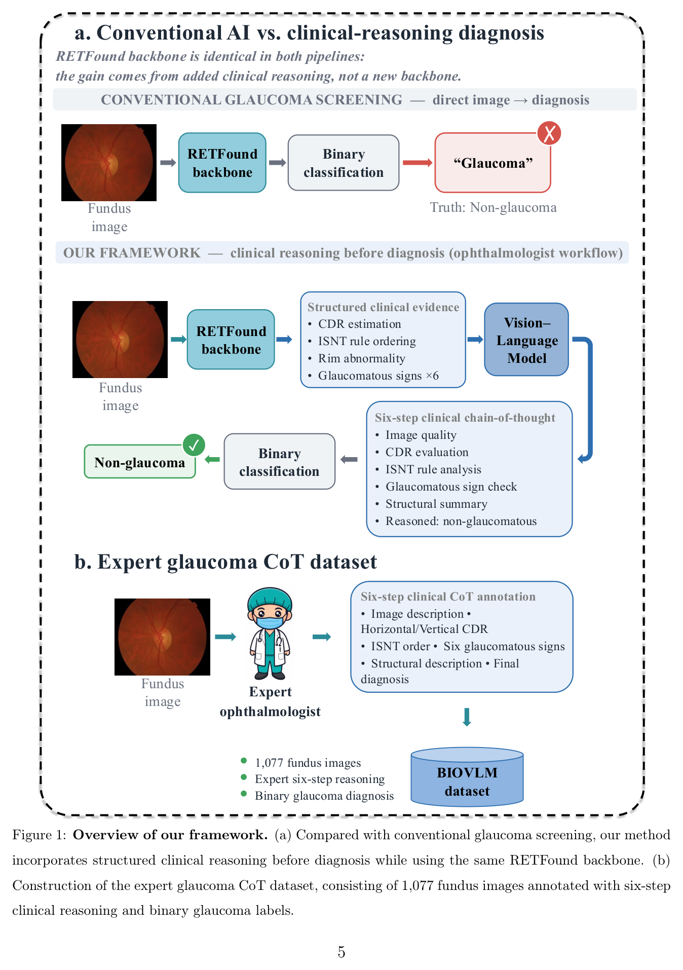 Overview of the framework: conventional AI vs. clinical-reasoning diagnosis, and construction of the expert glaucoma CoT dataset.