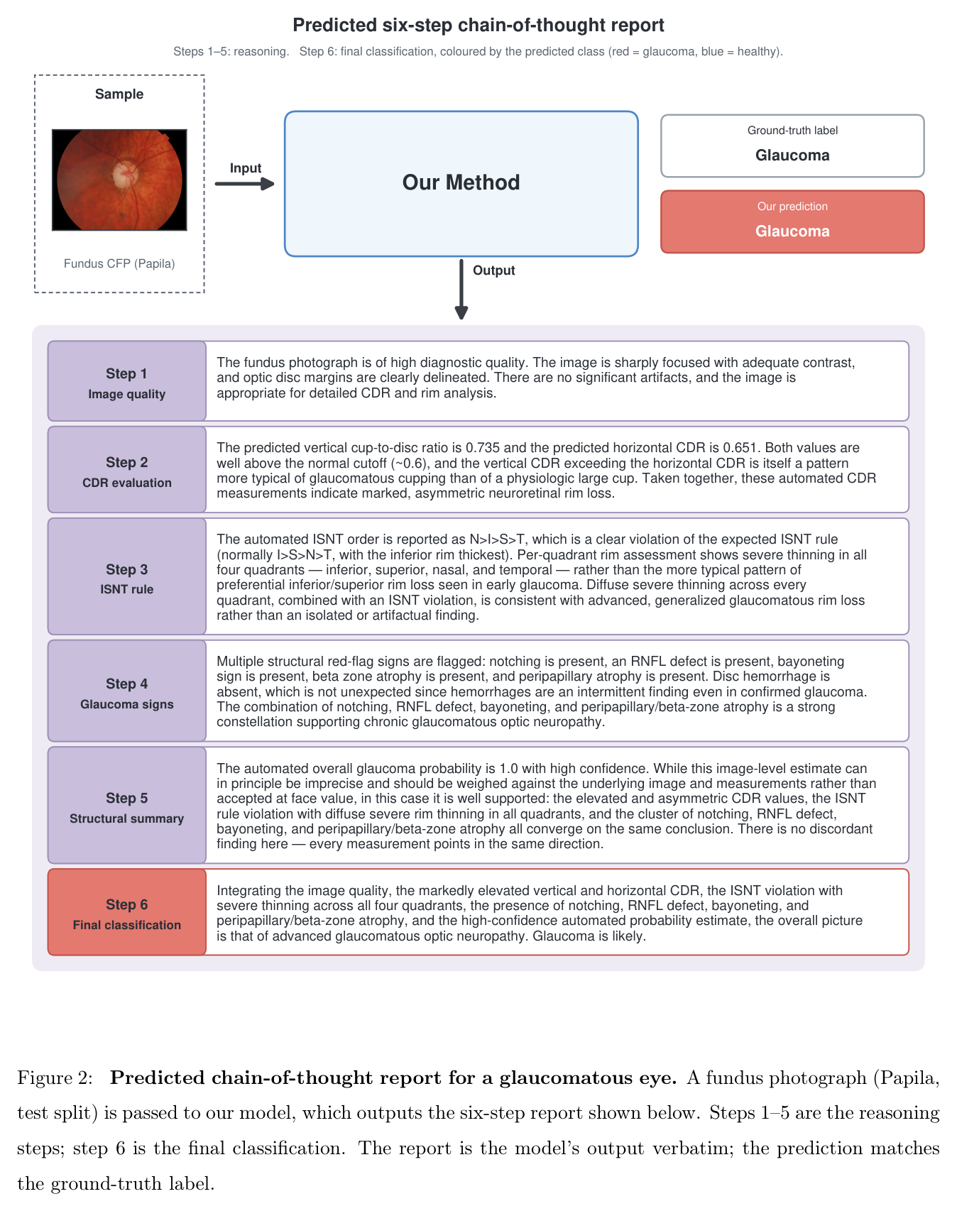 Predicted six-step chain-of-thought report for a glaucomatous eye.