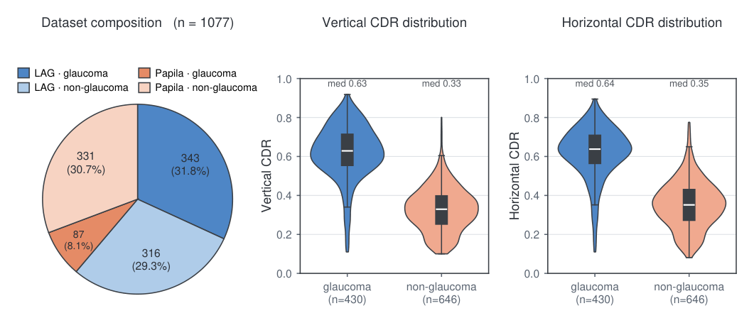 Dataset composition pie chart and vertical/horizontal cup-to-disc ratio distributions by diagnosis.